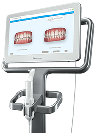 iTero Element scanner